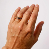 Anillo Sinuata