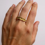 Anillo Sinuata