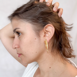 Aretes Fisura