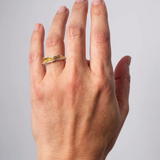 Anillo Sinuata